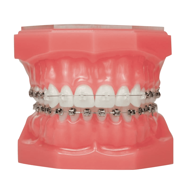 invisalign treatment